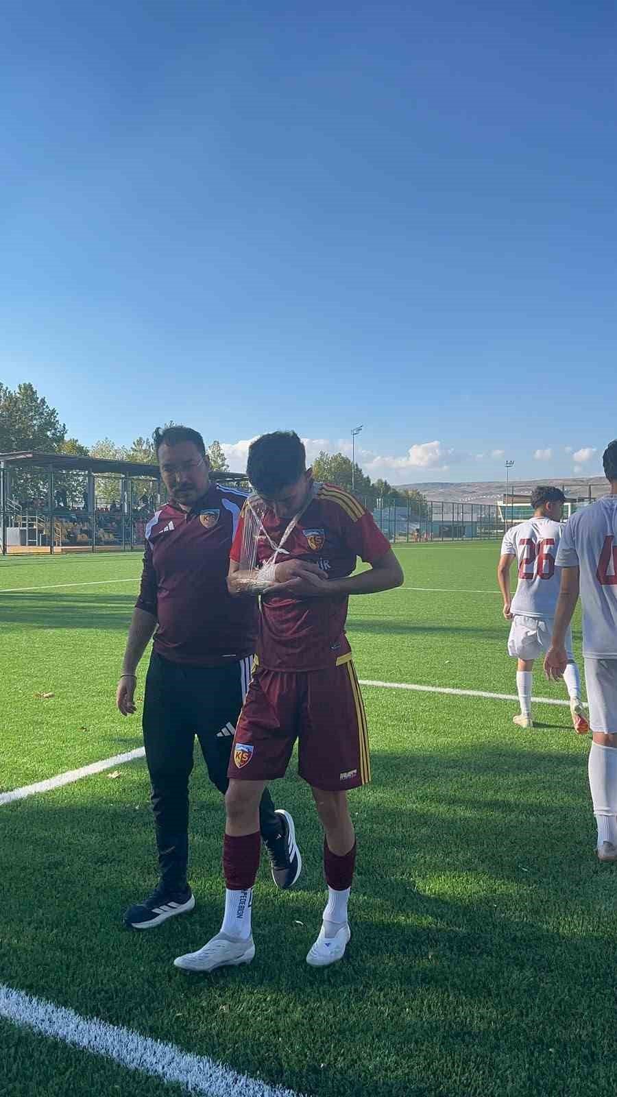 Kayserispor U19’da Hilmi Türkan’dan kötü haber