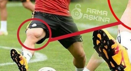 Podolski’nin Bacak Kası şaşırttı!