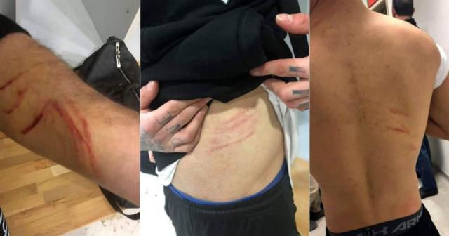 Şok iddia: “Amedsporlu oyuncu futbolcuları jiletle yaraladı"