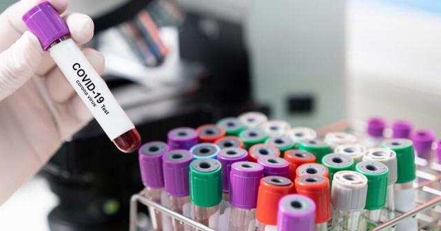 Boupendza ve Poko’nun testleri pozitif çıktı