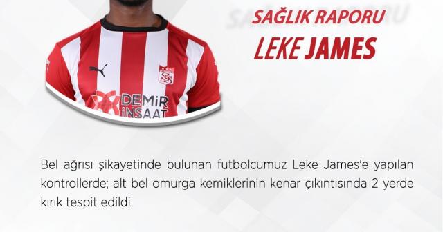 Sivasspor’a Leke James’ten kötü haber!